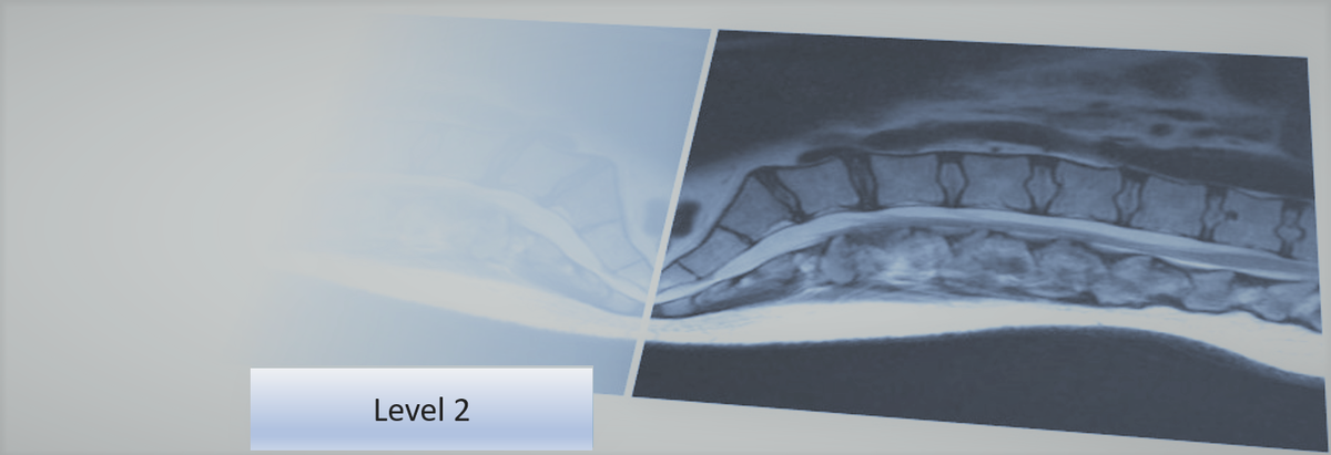 Level 2 Further Skills: Musculoskeletal Imaging Referral and Interpretation - Spine