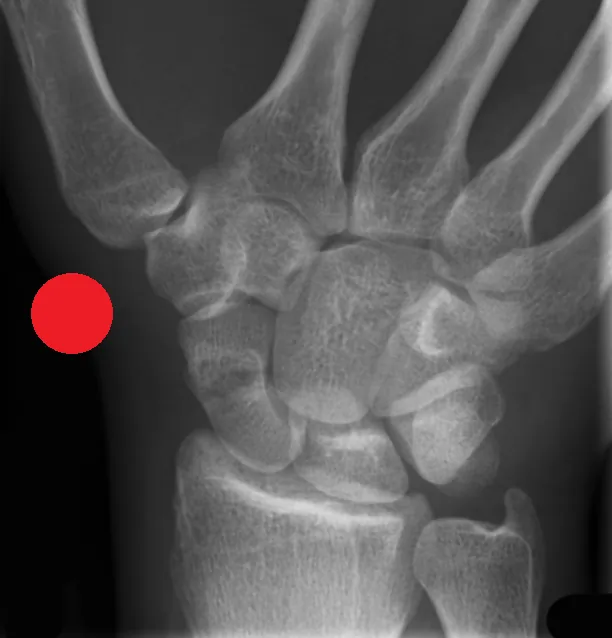 Red Dot Course for Radiographers (Online)