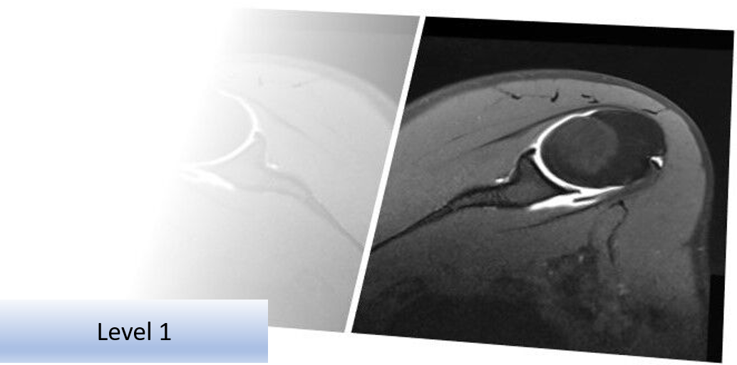 MSK Imaging Referral and Interpretation Course (Online) 2x half day - Level 1