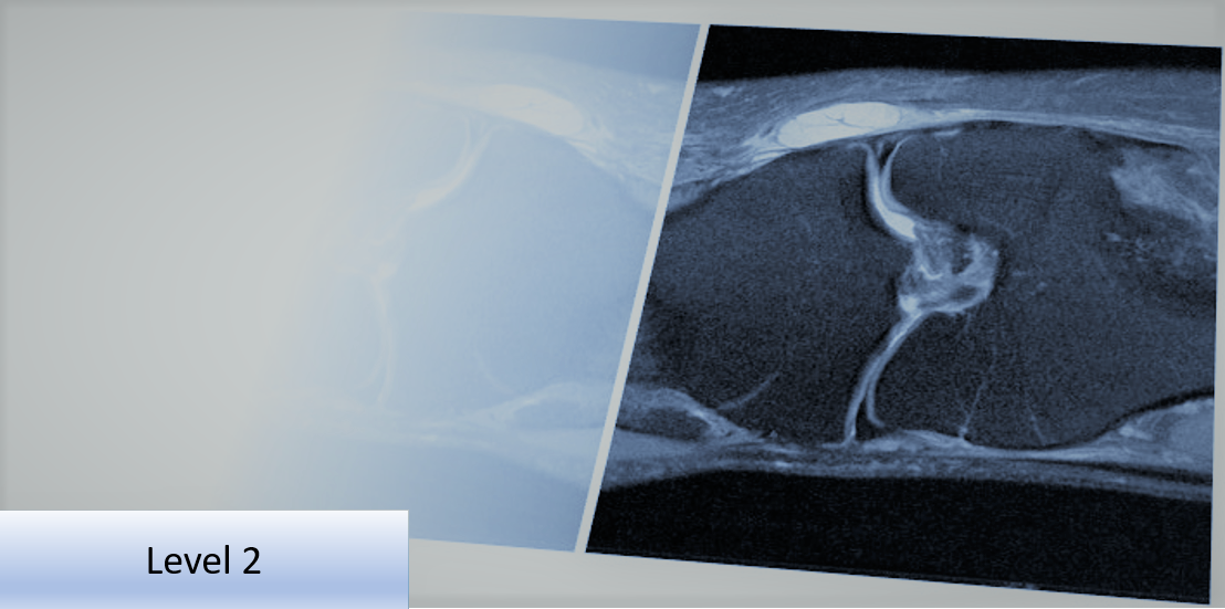 Level 2 Further Skills: Musculoskeletal Imaging Referral and Interpretation - Lower Limb