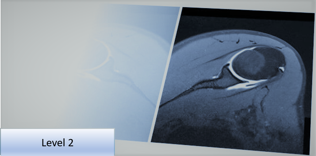 Level 2 Further Skills: Musculoskeletal Imaging Referral and Interpretation - Full Course Programme