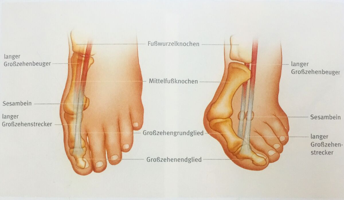 Hallux geplagt?