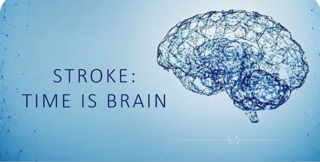 Stroke: Time is Brain