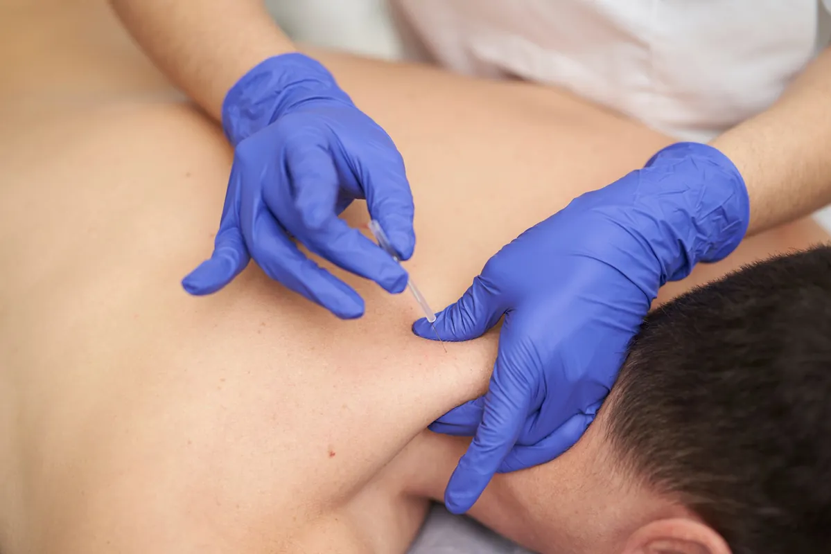 Master Class: Clinical Application for Dry Needling