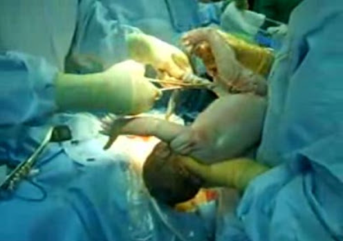 CORSO ECM "LE EMERGENZE IN SALA PARTO: BUONE PRATICHE CLINICHE E PROTOCOLLI NELLA GESTIONE DELLE EMERGENZE/URGENZE PERI-PARTUM"