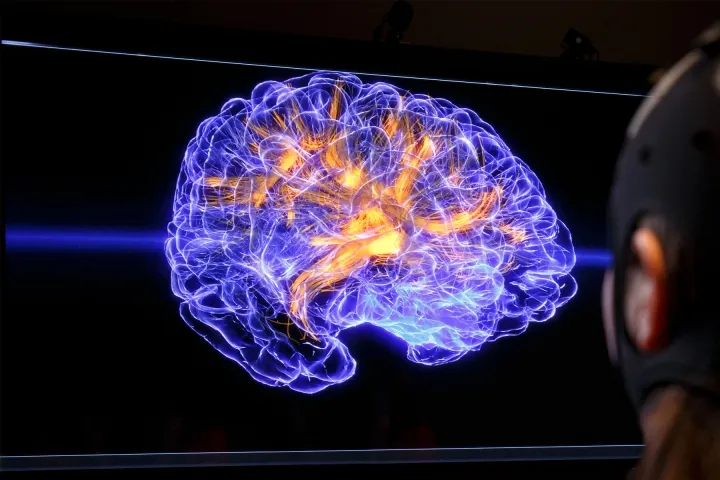 Simulazione nel paziente neurologico acuto