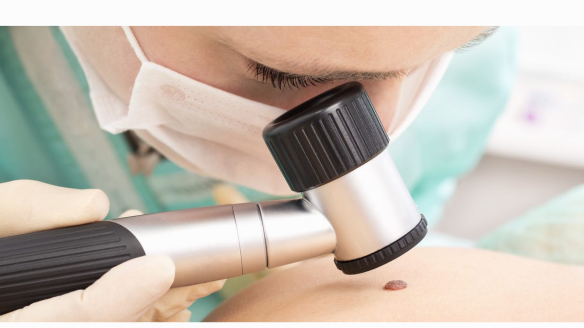 Lesion Recognition: From Visual Recognition to Dermoscopy